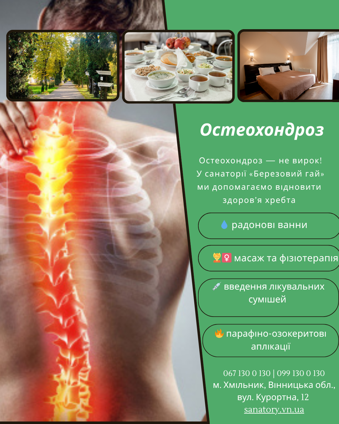Комплексне лікування остеохондрозу в санаторії «Березовий гай»., фото 1 Комплексне лікування остеохондрозу в санаторії «Березовий гай»., фото 1
